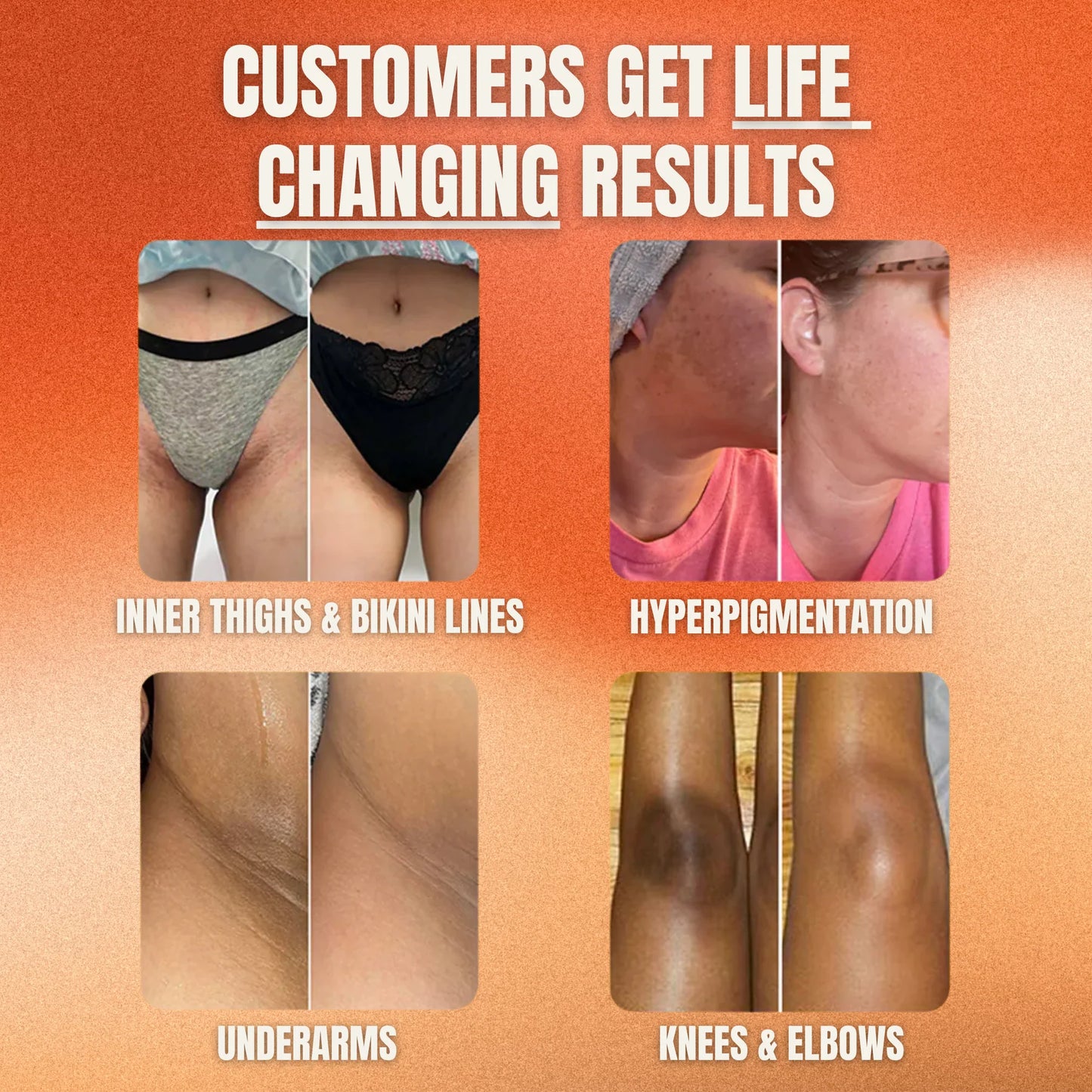 Glo Wash Turmeric & Kojic Acid - Buy One Get One FREE