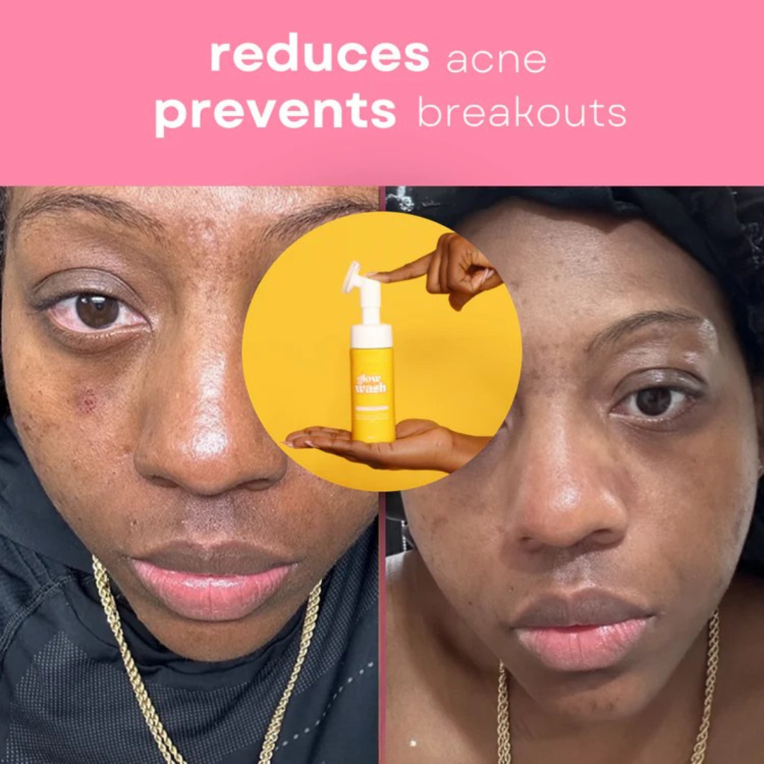 Glo Wash Turmeric & Kojic Acid - Buy One Get One FREE