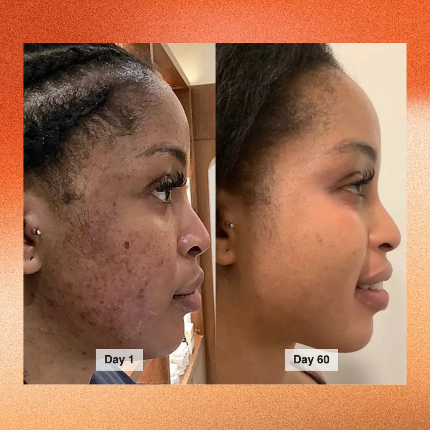 Glo Wash Turmeric & Kojic Acid - Buy One Get One FREE