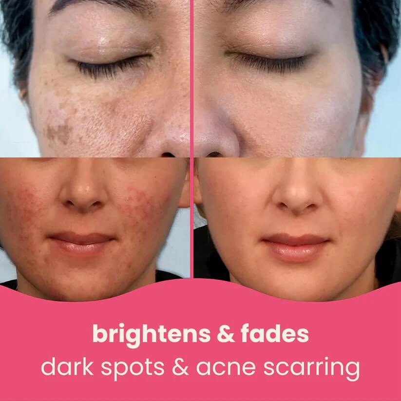 Brightening Turmeric & Kojic Acid Pads