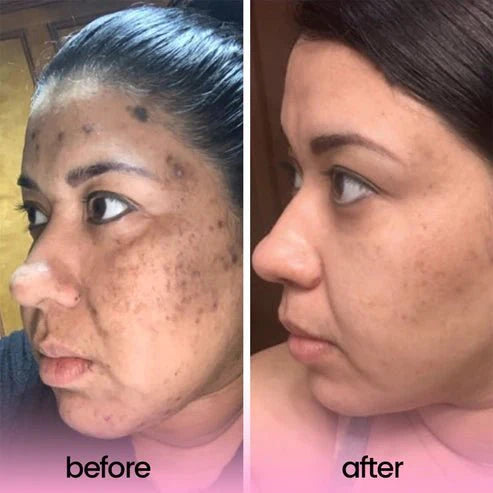 Comflux™ Brightening Set