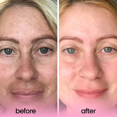 Brightening Turmeric & Kojic Acid Pads