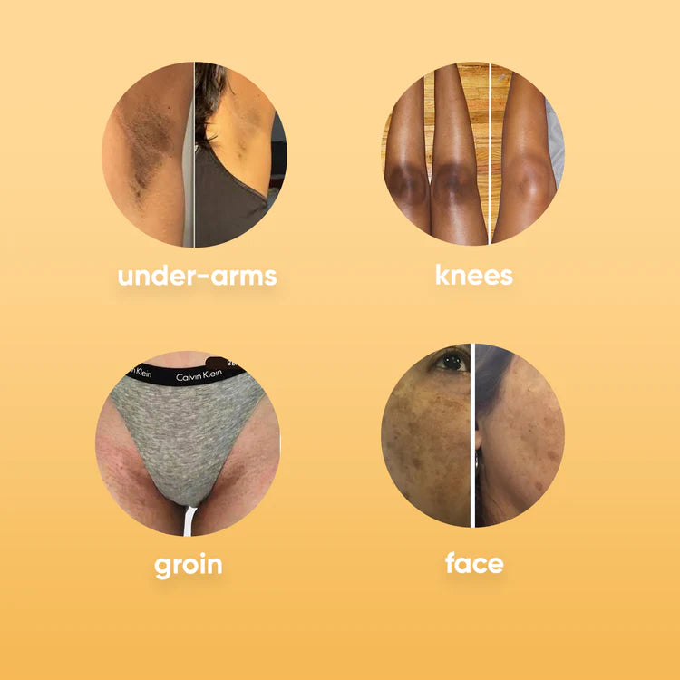 Brightening Turmeric & Kojic Acid Pads